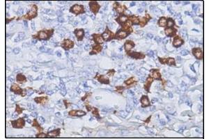 Immunohistochemistry (IHC) image for Mouse anti-Human IgG4 antibody (ABIN952860) (Mouse anti-Human IgG4 Antibody)