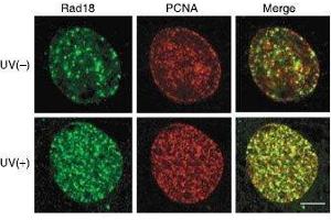 Immunofluorescence (IF) image for anti-E3 ubiquitin-protein ligase RAD18 (RAD18) (C-Term) antibody (ABIN2452086) (RAD18 antibody  (C-Term))