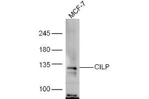 MCF-7 lysate probed with Rabbit Anti-CILP Polyclonal Antibody, Unconjugated  at 1:5000 for 90min at 37˚C. (CILP antibody  (AA 1051-1184))