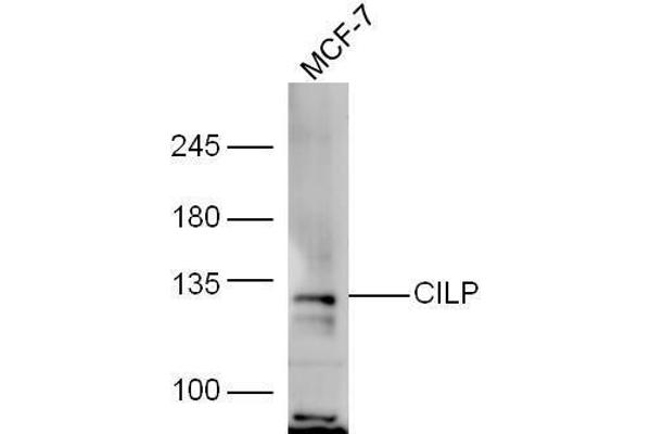 CILP 抗体  (AA 1051-1184)