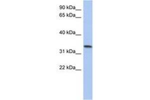 C10ORF96 Antikörper  (AA 143-192)