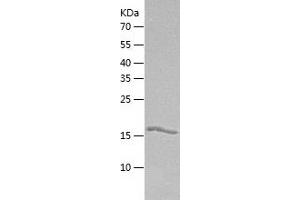 DCMP Deaminase (DCTD) (AA 1-178) protein (His tag)