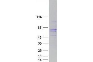 Validation with Western Blot (RCBTB1 Protein (Myc-DYKDDDDK Tag))