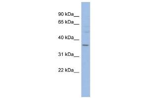 HMGCLL1 antibody used at 1 ug/ml to detect target protein.
