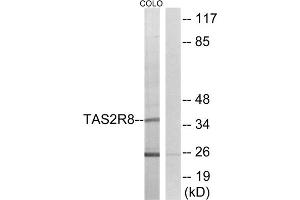 Western blot analysis of extracts from COLO cells, using TAS2R8 antibody. (TAS2R8 antibody  (Internal Region))