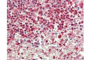 Anti-ACTG1 / Gamma Actin antibody IHC staining of human spleen. (Actin, gamma 1 antibody  (AA 188-215))
