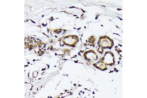 Immunohistochemistry of paraffin-embedded human breast using PSMD14 Rabbit mAb (ABIN7269588) at dilution of 1:100 (40x lens). (PSMD14 antibody)