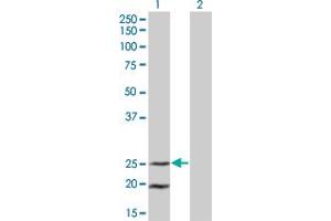 Western Blot analysis of IL6 expression in transfected 293T cell line by IL6 monoclonal antibody (M03), clone 3F4. (IL-6 antibody  (AA 29-212))