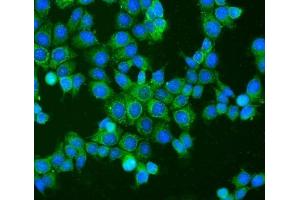 IF analysis of BAK using anti-BAK antibody (ABIN3042342). (BAK1 antibody  (AA 22-211))