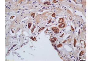 Formalin-fixed and paraffin embedded human kidney labeled with Anti-phospho-MLC(Ser20) /Myosin light chain(Ser20) Polyclonal Antibody, Unconjugated (ABIN872283) at 1:200 followed by conjugation to the secondary antibody and DAB staining (MYL9 antibody  (pSer20))