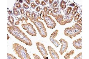 IHC analysis of CDK5 using anti-CDK5 antibody (ABIN6719393).
