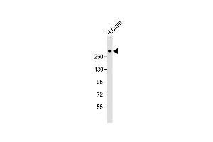 Anti-JMJD1C Antibody (C-Term) at 1:1000 dilution + human brain lysate Lysates/proteins at 20 μg per lane. (JMJD1C antibody  (AA 2019-2051))