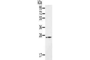 Western Blotting (WB) image for anti-RAB21, Member RAS Oncogene Family (RAB21) antibody (ABIN2433662) (RAB21 antibody)