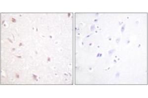 Immunohistochemistry (IHC) image for anti-MKI67 FHA Domain-Interacting Nucleolar Phosphoprotein (MKI67IP) (AA 200-249) antibody (ABIN2888898) (NIFK antibody  (AA 200-249))