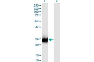 Western Blot analysis of LGALS3 expression in transfected 293T cell line by LGALS3 monoclonal antibody (M03), clone 3G8. (Galectin 3 antibody  (AA 1-250))