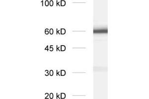 dilution: 1 : 2000, sample: crude synaptosomal fraction of rat brain (P2)