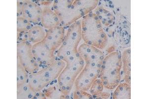 Used in DAB staining on fromalin fixed paraffin- embedded kidney tissue (RAB1A antibody  (AA 2-205))