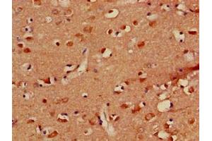 Immunohistochemistry of paraffin-embedded human brain tissue using ABIN7163717 at dilution of 1:100 (PLXND1 antibody  (AA 1-222))