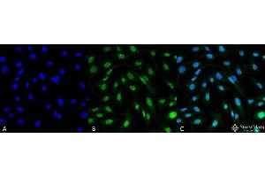Immunocytochemistry/Immunofluorescence analysis using Mouse Anti-MDC1 Monoclonal Antibody, Clone P2B11 . (MDC1 antibody  (N-Term) (Biotin))