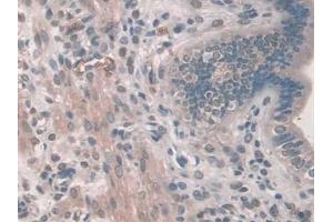 DAB staining on IHC-P; Samples: Mouse Uterus Tissue (PDE12 antibody  (AA 290-602))