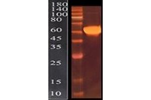 The recombinant Nucleocapsid-His protein migrates as 70 kDa due to glycosylation (SARS-CoV-2 Nucleocapsid Protein (SARS-CoV-2 N) (AA 1-419) (His tag))