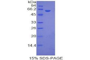 SDS-PAGE analysis of Human LRP8 Protein. (LRP8 Protein)