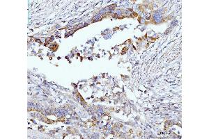 IHC analysis of Glutaminase/GLS using anti-Glutaminase/GLS antibody (ABIN7601601). (Glutaminase antibody  (AA 396-654))