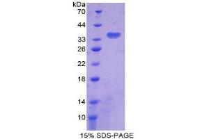 SDS-PAGE (SDS) image for Citrate Synthase (CS) (AA 103-394) protein (His tag) (ABIN2124345) (CS Protein (AA 103-394) (His tag))