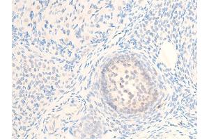ABIN6267244 at 1/100 staining rat ovarian tissue sections by IHC-P. (MITF antibody  (pSer73, pSer180))