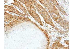 IHC-P Image Immunohistochemical analysis of paraffin-embedded SG xenograft, using HSPA6, antibody at 1:500 dilution. (HSPA6 antibody  (Center))