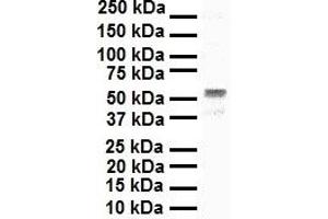 WB Suggested Anti-SNAI1 antibody Titration: 1 ug/mL Sample Type: Human A549 (SNAIL antibody  (N-Term))