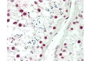 Human Testis: Formalin-Fixed, Paraffin-Embedded (FFPE) (PDS5B antibody  (C-Term))