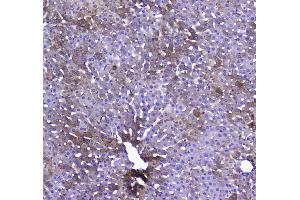 IHC analysis of COX IV using anti-COX IV antibody . (COX IV antibody  (AA 59-169))