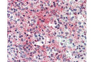 Anti-CCL5 / RANTES antibody IHC of human spleen. (CCL5 antibody)