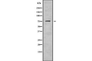 Western blot analysis of DDX18 using HuvEc whole cell lysates (DDX18 antibody  (N-Term))