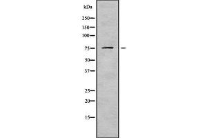 Western blot analysis of DDX18 using HuvEc whole cell lysates (DDX18 antibody  (N-Term))