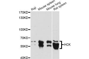 Western blot analysis of extracts of various cell lines, using HCK antibody. (HCK antibody)