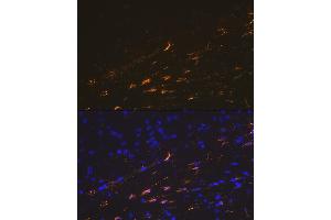 Immunofluorescence analysis of mouse brain cells using GFAP Rabbit pAb (ABIN3020750, ABIN3020751, ABIN3020752, ABIN1512943 and ABIN6213705) at dilution of 1:100 (40x lens). (GFAP antibody  (C-Term))
