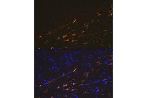 Immunofluorescence analysis of mouse brain cells using GFAP Rabbit pAb (ABIN3020750, ABIN3020751, ABIN3020752, ABIN1512943 and ABIN6213705) at dilution of 1:100 (40x lens). (GFAP antibody  (C-Term))