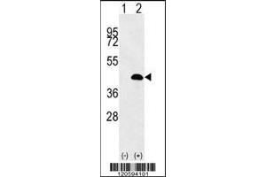 Western blot analysis of LUC7L using rabbit polyclonal LUC7L Antibody using 293 cell lysates (2 ug/lane) either nontransfected (Lane 1) or transiently transfected (Lane 2) with the LUC7L gene. (LUC7L antibody  (AA 219-246))