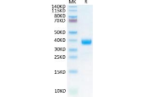 Cynomolgus NKp46 on Tris-Bis PAGE under reduced condition. (NCR1 Protein (AA 22-254) (His tag))