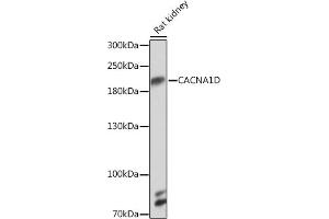 Western blot analysis of extracts of Rat kidney, using CD Rabbit pAb (ABIN7266013) at 1:1000 dilution. (CACNA1D antibody  (AA 1882-2181))