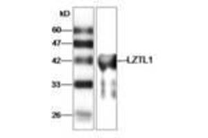 Image no. 1 for anti-Leucine Zipper Transcription Factor-Like 1 (LZTFL1) antibody (ABIN791460) (LZTFL1 antibody)
