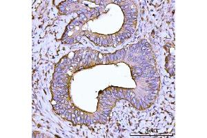 IHC analysis of Alpha Actinin 4 using anti-Alpha Actinin 4 antibody (ABIN4886421).