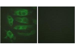Immunofluorescence analysis of HeLa cells, using Adrenergic Receptor beta2 (Ab-346) Antibody. (beta 2 Adrenergic Receptor antibody  (AA 321-370))