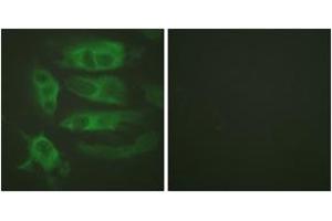 Immunofluorescence analysis of HeLa cells, using Adrenergic Receptor beta2 (Ab-346) Antibody.
