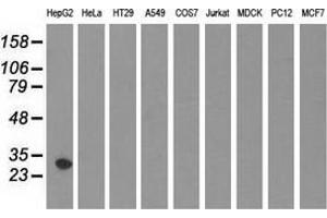 Western blot analysis of extracts (35 µg) from 9 different cell lines by using anti-SULT2A1 monoclonal antibody. (SULT2A1 antibody)