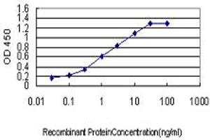Detection limit for recombinant GST tagged MCC is approximately 0. (MCC antibody  (AA 31-130))