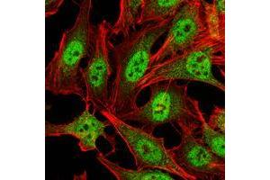 Immunofluorescence analysis of Hela cells using CRAM1 mouse mAb (green). (CARM1 antibody)