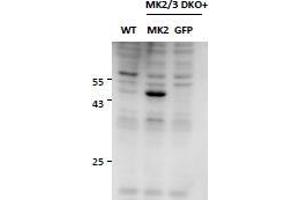 Western Blotting (WB) image for anti-Mitogen-Activated Protein Kinase-Activated Protein Kinase 2 (MAPKAPK2) antibody (ABIN5903087) (MAPKAP Kinase 2 antibody)